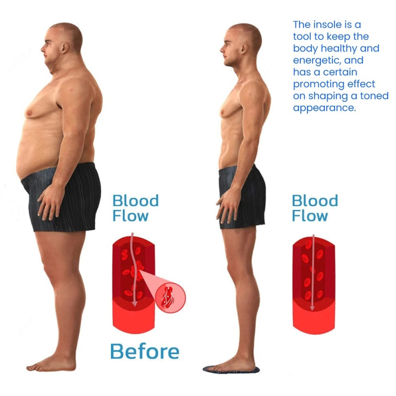 HOUKEA 1 par magnetiske akupressurstøttende svangindsatser