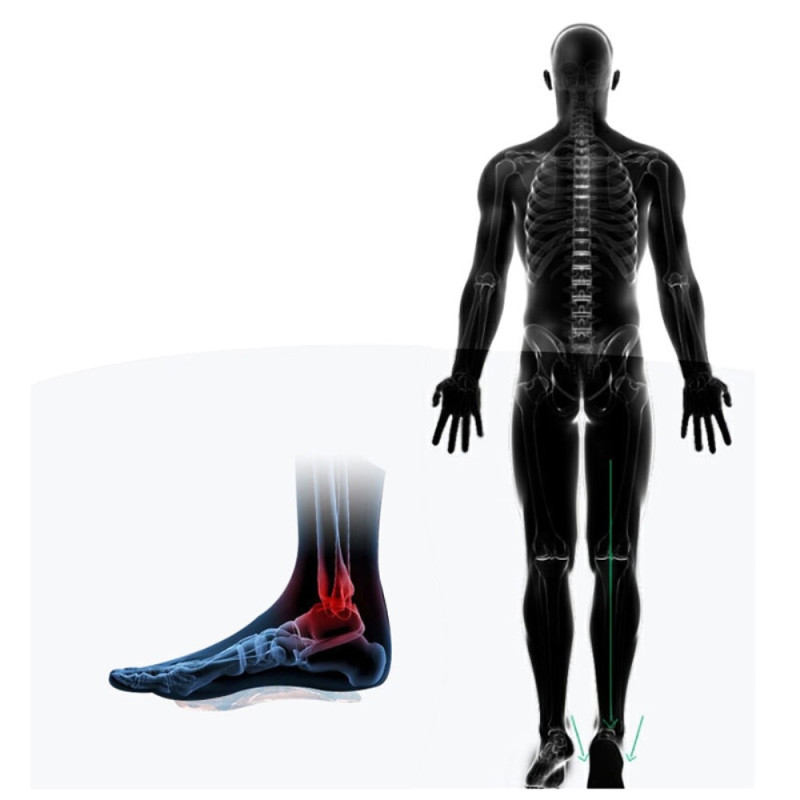 insole Flat foot support high heel inserts Pain relief - L